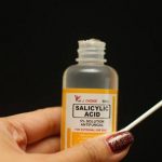 Salicylic Acid